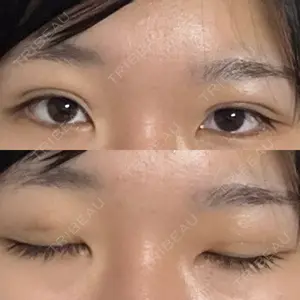 湘南美容クリニック 湘南美容クリニック 千葉センシティ院口コミ