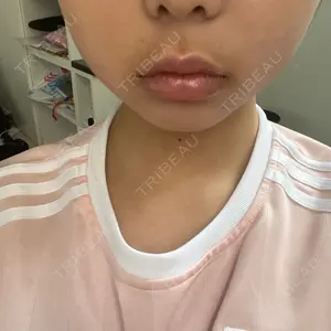 HAAB CLINIC HAAB×DREAM BEAUTY CLINIC 東京本院口コミ