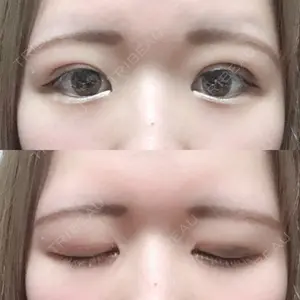 湘南美容クリニック 湘南美容クリニック 松山院口コミ