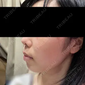 トラスト美容クリニック トラスト美容クリニック 銀座院口コミ