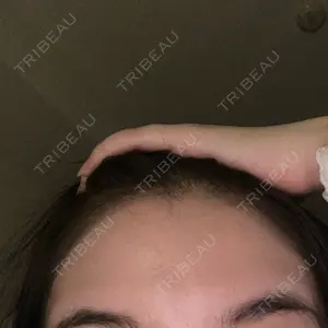 池袋美容クリニック 池袋美容クリニック口コミ