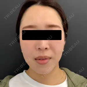 BLINC CLINIC （ブリンク クリニック）口コミ