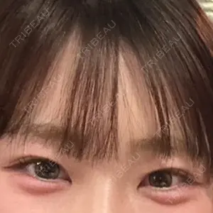 口コミ