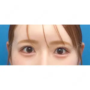 口コミ