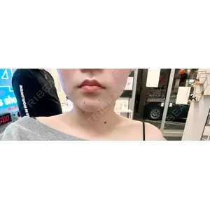 口コミ