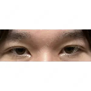 東京イセアクリニック口コミ