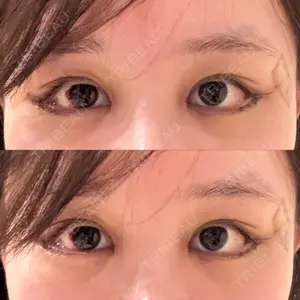口コミ