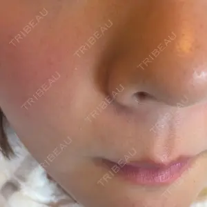ルラ美容クリニック ルラ美容クリニック銀座院口コミ