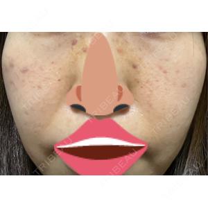 LIFIX BEAUTY CLINIC口コミ