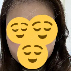 TCB東京中央美容外科 TCB東京中央美容外科 神戸院口コミ