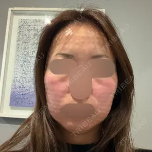 ソウルアイ美容外科医院口コミ