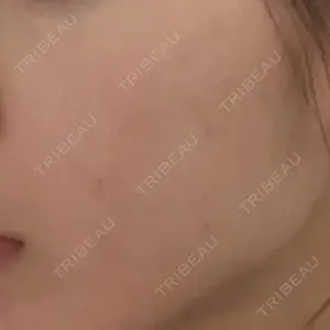 トラスト美容クリニック トラスト美容クリニック 銀座院口コミ