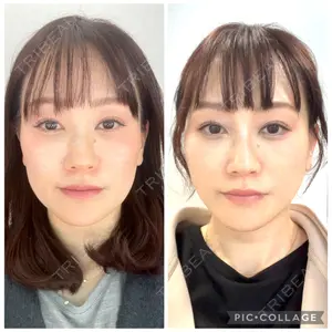 口コミ