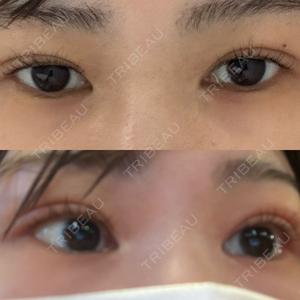 TCB東京中央美容外科 TCB東京中央美容外科 銀座有楽町院口コミ