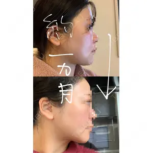 HAAB CLINIC HAAB×DREAM BEAUTY CLINIC 東京本院口コミ
