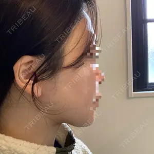 HAAB CLINIC HAAB×DREAM BEAUTY CLINIC 東京本院口コミ