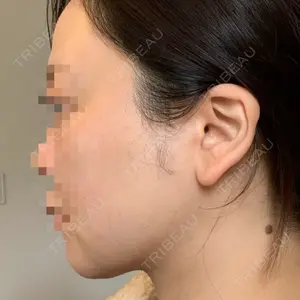 HAAB CLINIC HAAB×DREAM BEAUTY CLINIC 東京本院口コミ