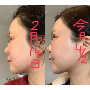 HAAB CLINIC HAAB×DREAM BEAUTY CLINIC 東京本院口コミ