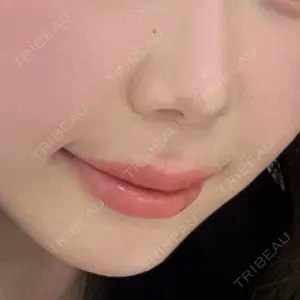 HAAB CLINIC HAAB×DREAM BEAUTY CLINIC 東京本院口コミ