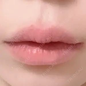 HAAB CLINIC HAAB×DREAM BEAUTY CLINIC 東京本院口コミ