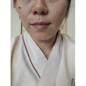 口コミ