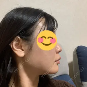 口コミ