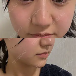 口コミ