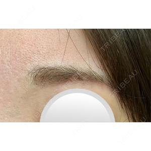 プロクリニック PRO CLINIC プロクリニック 銀座院口コミ