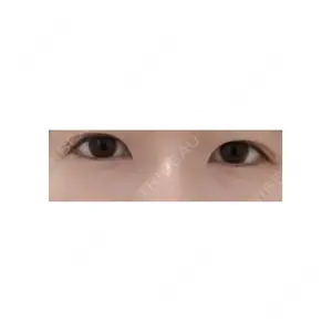 プラストクリニック口コミ