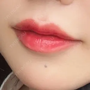 口コミ