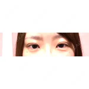 口コミ