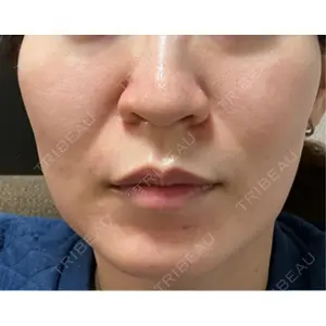 美容皮膚科ティファクリニック 美容皮膚科ティファクリニック 横浜院口コミ