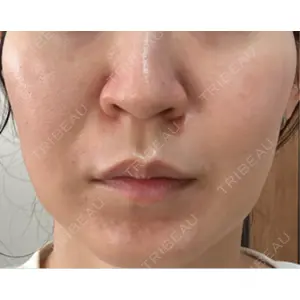 美容皮膚科ティファクリニック 美容皮膚科ティファクリニック 横浜院口コミ