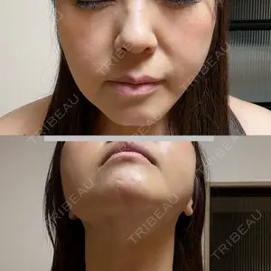 HAAB CLINIC HAAB×DREAM BEAUTY CLINIC 東京本院口コミ