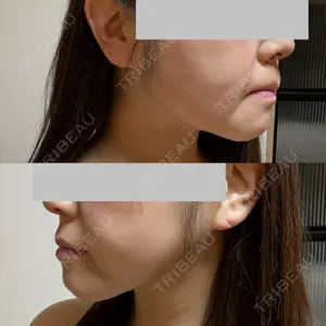 HAAB CLINIC HAAB×DREAM BEAUTY CLINIC 東京本院口コミ