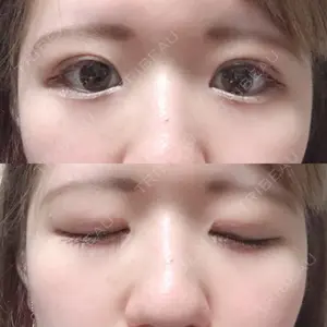 湘南美容クリニック 湘南美容クリニック 松山院口コミ