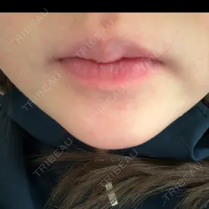 プロクリニック PRO CLINIC プロクリニック 銀座院口コミ