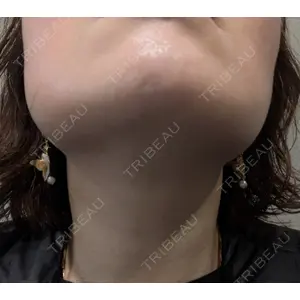 池袋美容クリニック 池袋美容クリニック口コミ