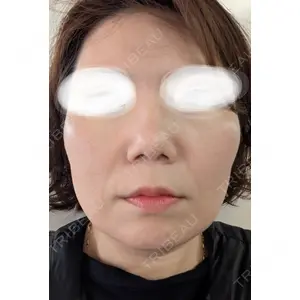 池袋美容クリニック 池袋美容クリニック口コミ