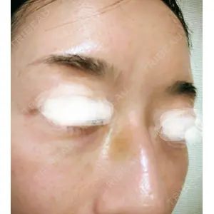 美容皮膚科ティファクリニック 美容皮膚科ティファクリニック 横浜院口コミ