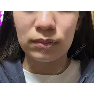 口コミ