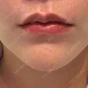 口コミ