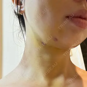 藤・ナチュレ美容クリニック 藤・ナチュレ美容クリニック 銀座院口コミ