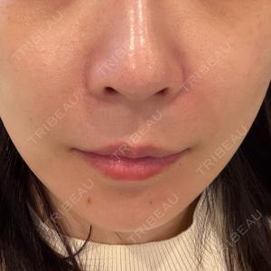 湘南美容クリニック 湘南美容クリニック 名古屋栄院口コミ