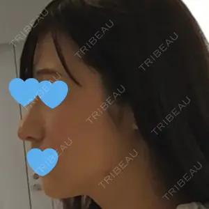 HANABI整形外科口コミ