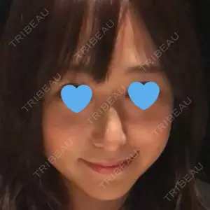 HANABI整形外科口コミ