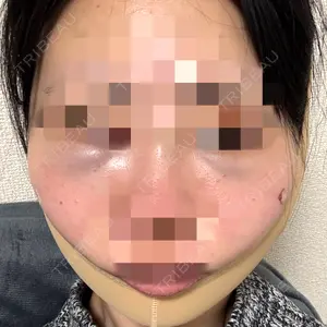 藤・ナチュレ美容クリニック 藤・ナチュレ美容クリニック 銀座院口コミ