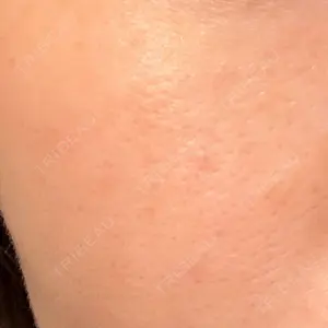 おおたかの森ビューティークリニック おおたかの森ビューティークリニック口コミ