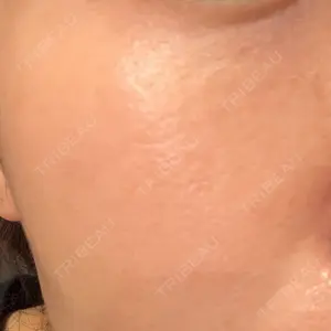 おおたかの森ビューティークリニック おおたかの森ビューティークリニック口コミ