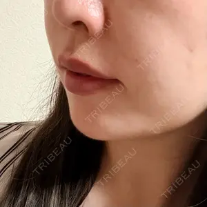 HAAB CLINIC HAAB×DREAM BEAUTY CLINIC 東京本院口コミ